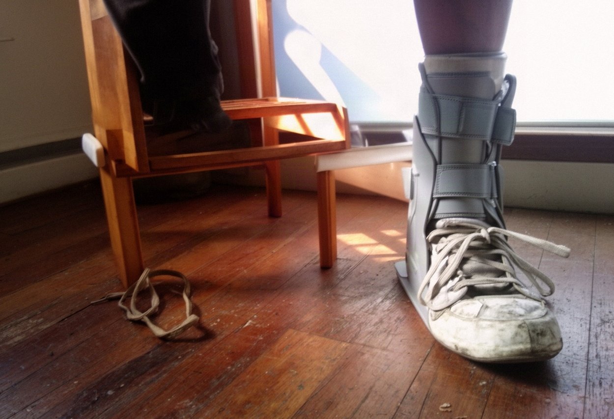 Noga w ortopedycznym bucie stabilizującym oparta na podnóżku w słonecznym pokoju